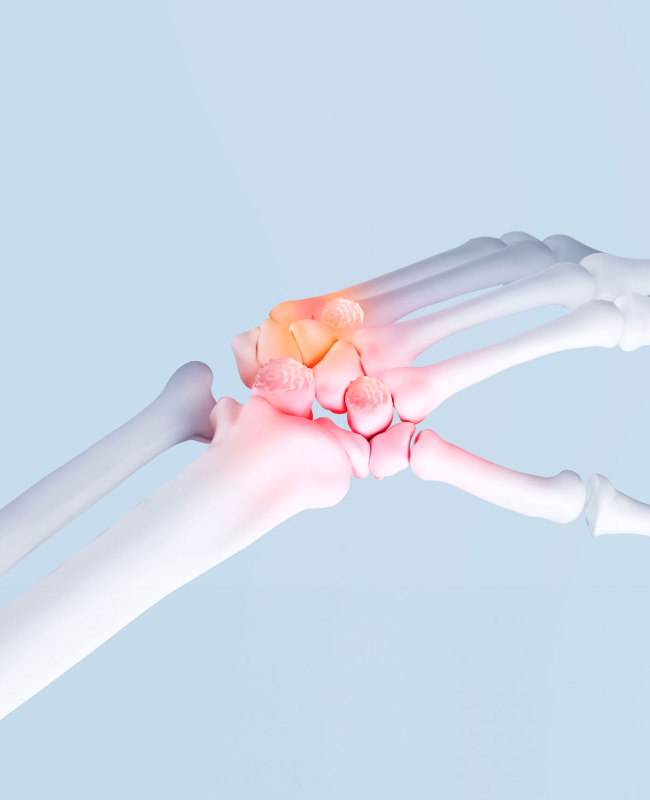 손·발 통증